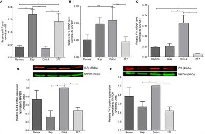 MicroRNA-7 Regulates Migration and Chemoresistance in Non-Hodgkin Lymphoma Cells Through Regulation of KLF4 and YY1